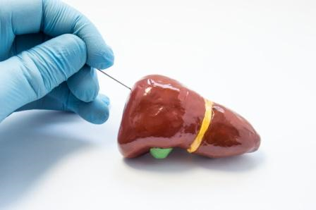 An overview of liver segmentation