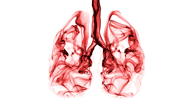 Clinical, pathological and radiological features of central airway pathology