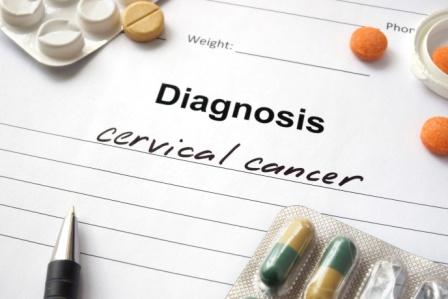 Cervical cancer_Small