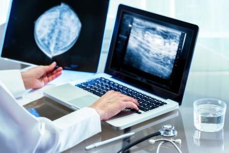 Mammography diagnosis performance under evaluation