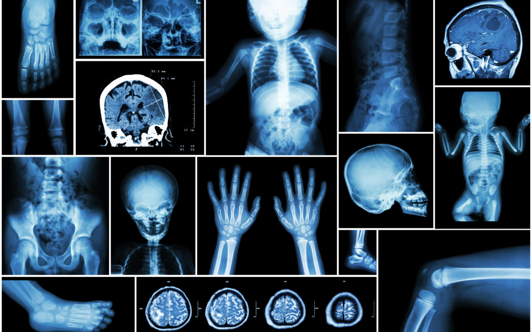 Postmortem fetal magnetic resonance imaging