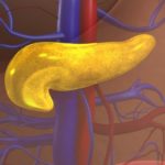 Abdominal manifestations of IgG4-related disease