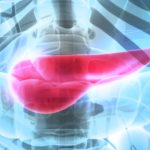 Imaging presentation of pancreatic neuroendocrine neoplasms