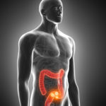 Response after neoadjuvant rectal cancer treatment